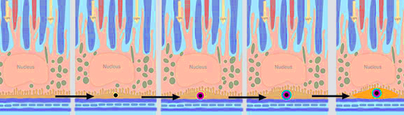 A schematic representation of how HAP and surrounding deposits form in the retina, blocking the movement of nutrients and waste. Source: Richard Thompson